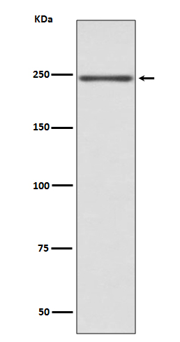 1 - Anti-Myosin heavy chain MYH6 Rabbit Monoclonal Antibody ABO14259