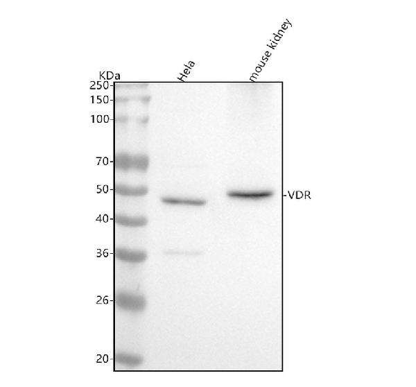 1 - Anti-Vitamin D Receptor VDR Rabbit Monoclonal Antibody ABO14260