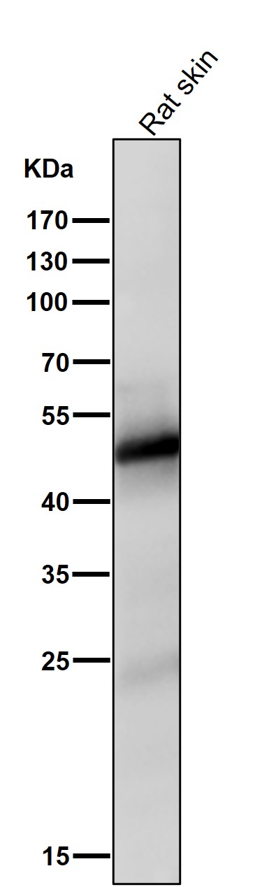 1 - Anti-Vitamin D Receptor VDR Rabbit Monoclonal Antibody ABO14260