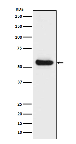 1 - Anti-Lipoprotein lipase LPL Rabbit Monoclonal Antibody ABO14261