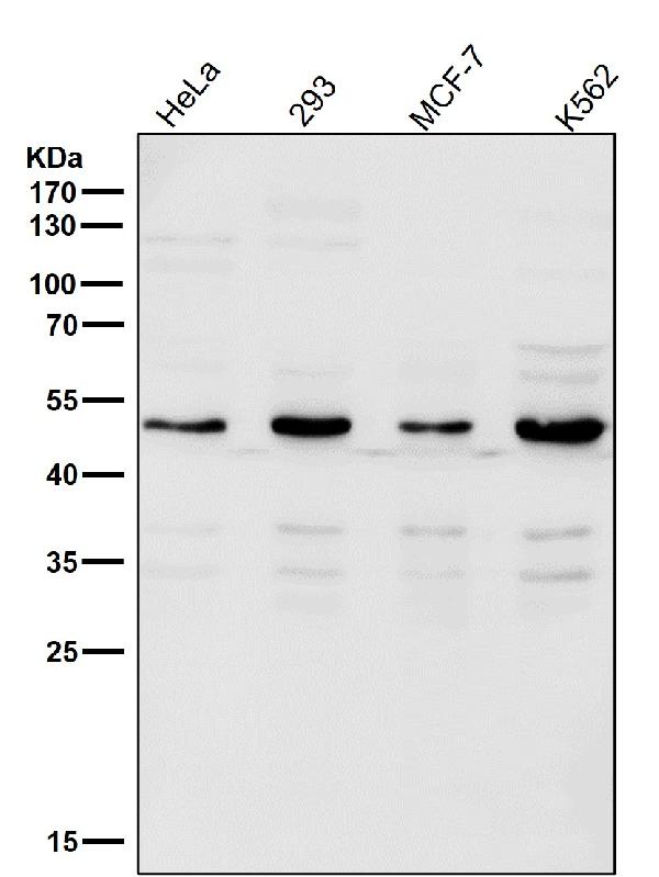1 - Anti-Lipoprotein lipase LPL Rabbit Monoclonal Antibody ABO14261