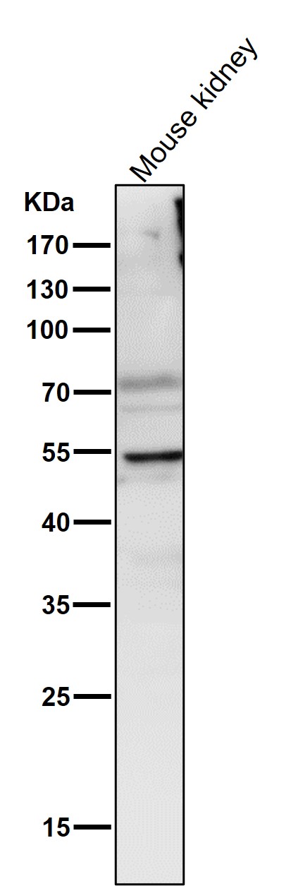 1 - Anti-Lipoprotein lipase LPL Rabbit Monoclonal Antibody ABO14261