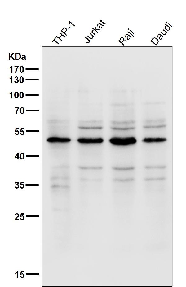 1 - Anti-Lipoprotein lipase LPL Rabbit Monoclonal Antibody ABO14261