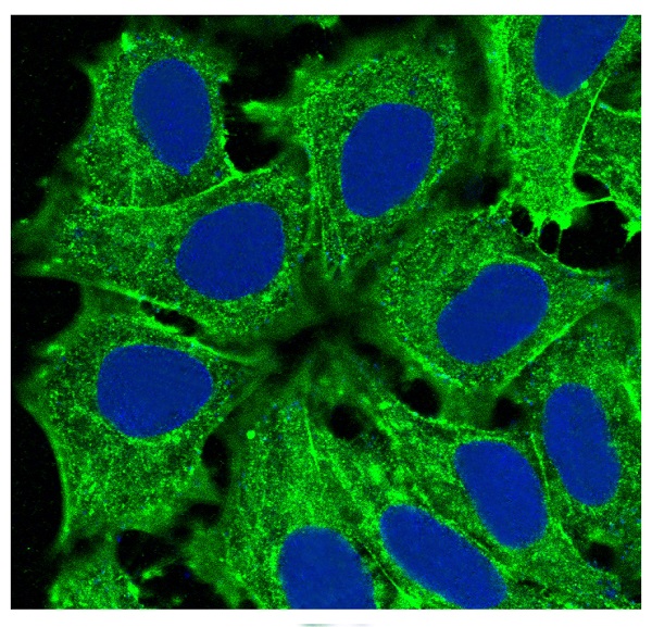 3 - Anti-Actin (Alpha-Actin) ACTA1 Rabbit Monoclonal Antibody ABO14262
