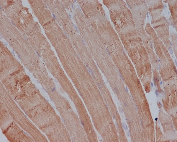 2 - Anti-Actin (Alpha-Actin) ACTA1 Rabbit Monoclonal Antibody ABO14262