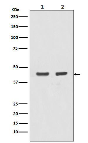 1 - Anti-Actin (Alpha-Actin) ACTA1 Rabbit Monoclonal Antibody ABO14262