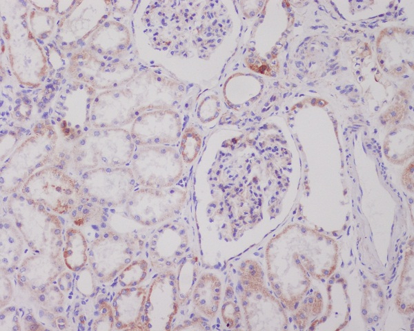2 - Anti-PI 3 Kinase Class 3 PIK3C3 Rabbit Monoclonal Antibody ABO14263
