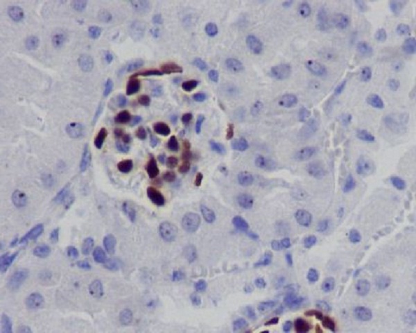 2 - Anti-Wilms Tumor Protein WT1 Rabbit Monoclonal Antibody ABO14264