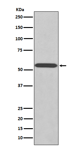 1 - Anti-Wilms Tumor Protein WT1 Rabbit Monoclonal Antibody ABO14264