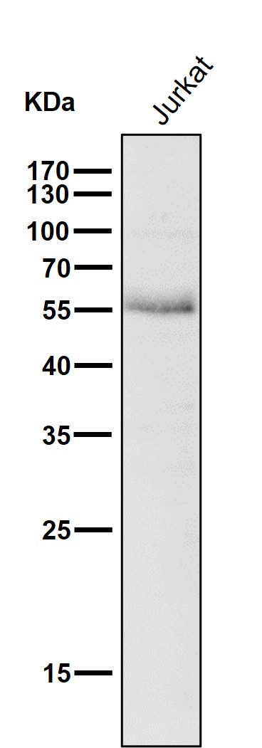 1 - Anti-Wilms Tumor Protein WT1 Rabbit Monoclonal Antibody ABO14264
