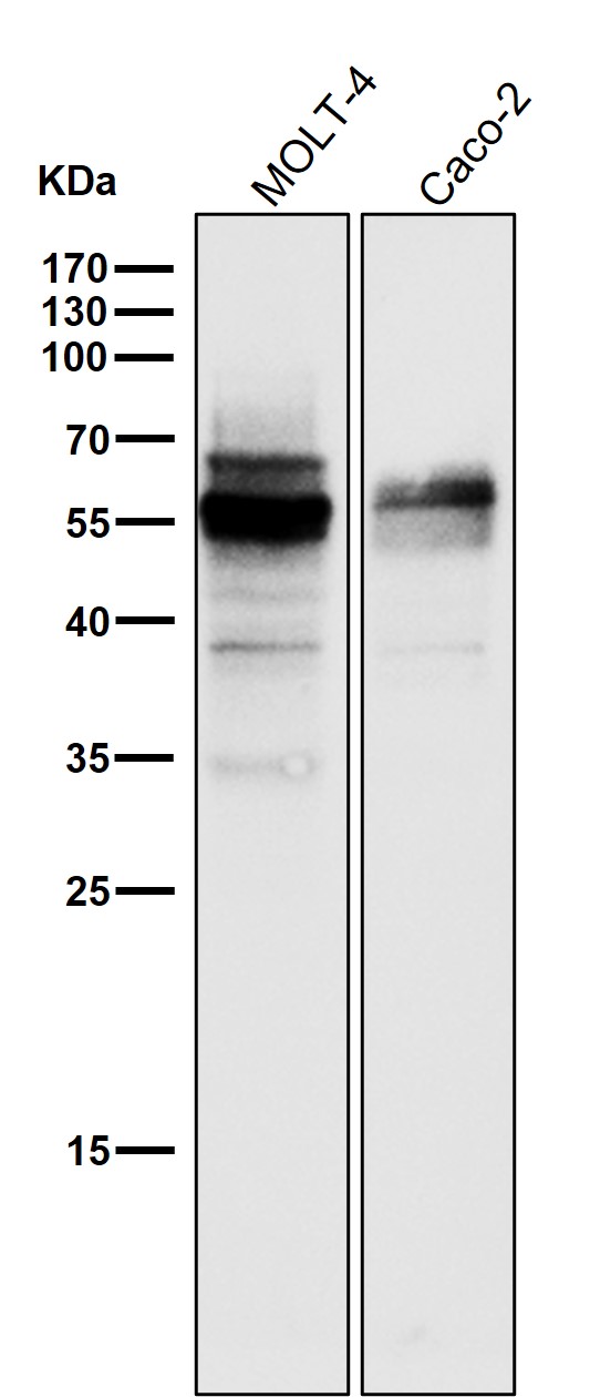 1 - Anti-Wilms Tumor Protein WT1 Rabbit Monoclonal Antibody ABO14264