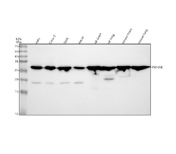 1 - Anti-14-3-3 alpha + beta YWHAB Rabbit Monoclonal Antibody ABO14266
