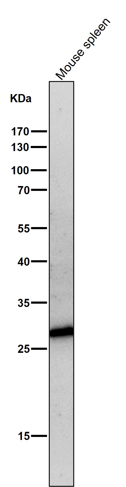 1 - Anti-Neutrophil Elastase ELANE Rabbit Monoclonal Antibody ABO14267