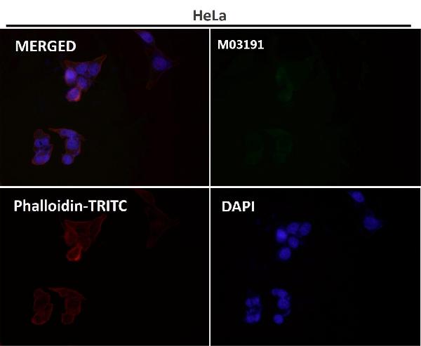 1 - Anti-Glutamine Synthetase GLUL Rabbit Monoclonal Antibody ABO14269