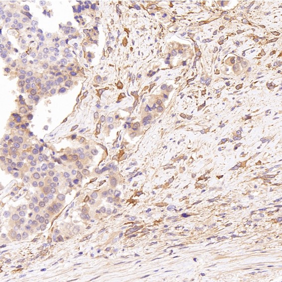 2 - Anti-Glutamine Synthetase GLUL Rabbit Monoclonal Antibody ABO14269