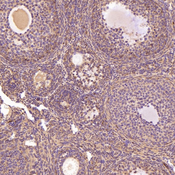 2 - Anti-Glutamine Synthetase GLUL Rabbit Monoclonal Antibody ABO14269