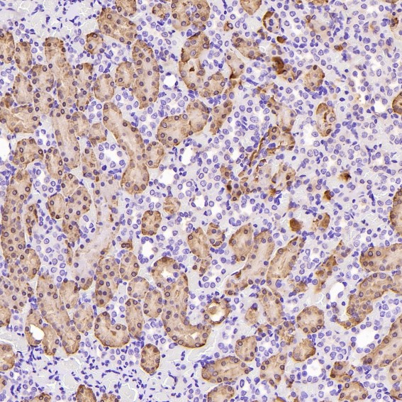 2 - Anti-Glutamine Synthetase GLUL Rabbit Monoclonal Antibody ABO14269