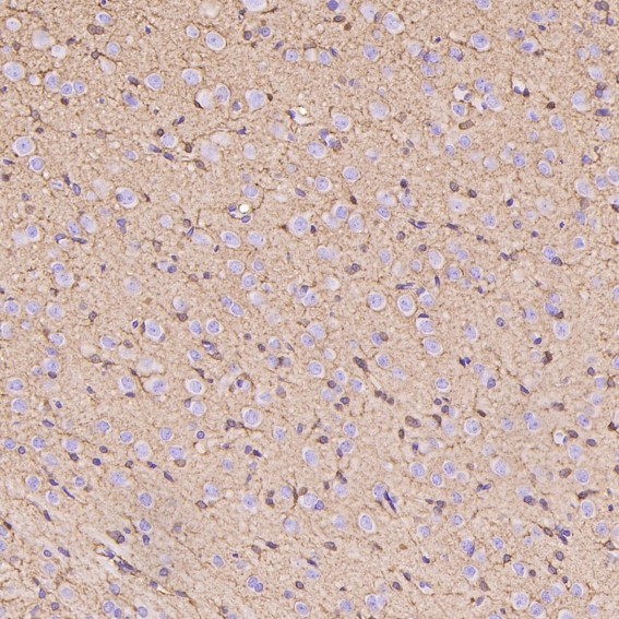2 - Anti-Glutamine Synthetase GLUL Rabbit Monoclonal Antibody ABO14269