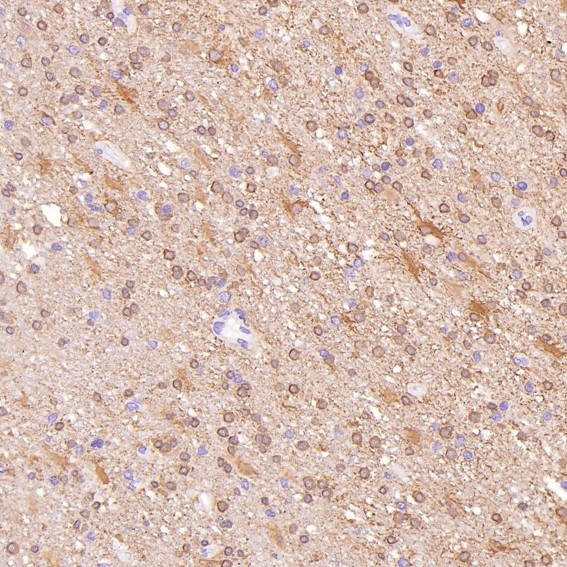 2 - Anti-Glutamine Synthetase GLUL Rabbit Monoclonal Antibody ABO14269
