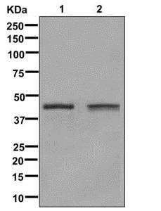 1 - Anti-Glutamine Synthetase GLUL Rabbit Monoclonal Antibody ABO14269