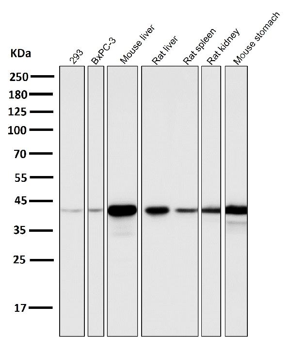 1 - Anti-Glutamine Synthetase GLUL Rabbit Monoclonal Antibody ABO14269