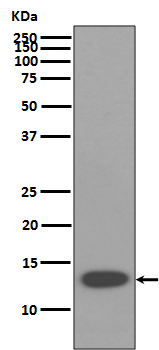 1 - Anti-beta 2 Microglobulin B2M Rabbit Monoclonal Antibody ABO14270