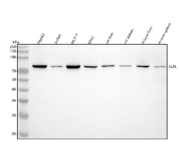 1 - Anti-Alkaline Phosphatase ALPL Rabbit Monoclonal Antibody ABO14271