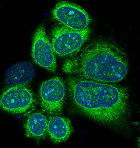 3 - Anti-Alkaline Phosphatase ALPL Rabbit Monoclonal Antibody ABO14271