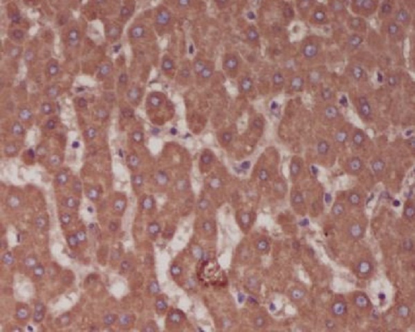 2 - Anti-Alkaline Phosphatase ALPL Rabbit Monoclonal Antibody ABO14271