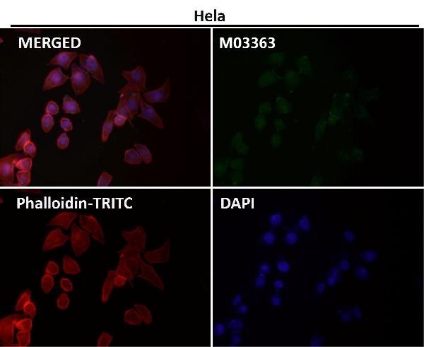 1 - Anti-PI 3 Kinase p85 beta PIK3R2 Rabbit Monoclonal Antibody ABO14272