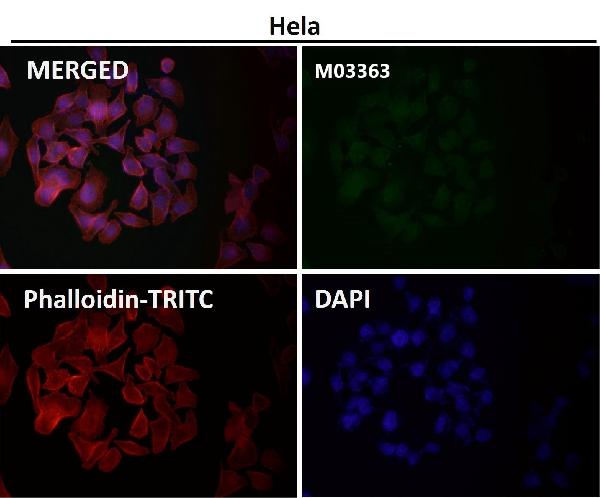 1 - Anti-PI 3 Kinase p85 beta PIK3R2 Rabbit Monoclonal Antibody ABO14272