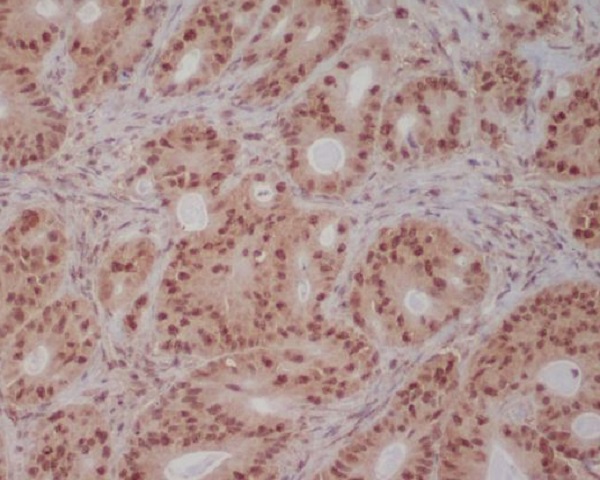 2 - Anti-PI 3 Kinase p85 beta PIK3R2 Rabbit Monoclonal Antibody ABO14272