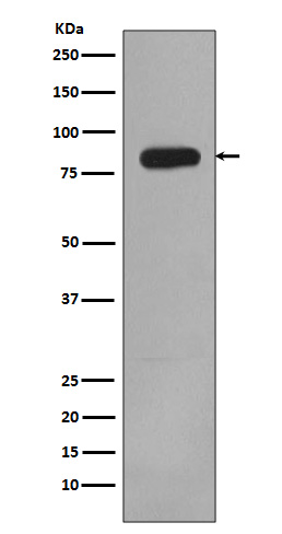 1 - Anti-PI 3 Kinase p85 beta PIK3R2 Rabbit Monoclonal Antibody ABO14272