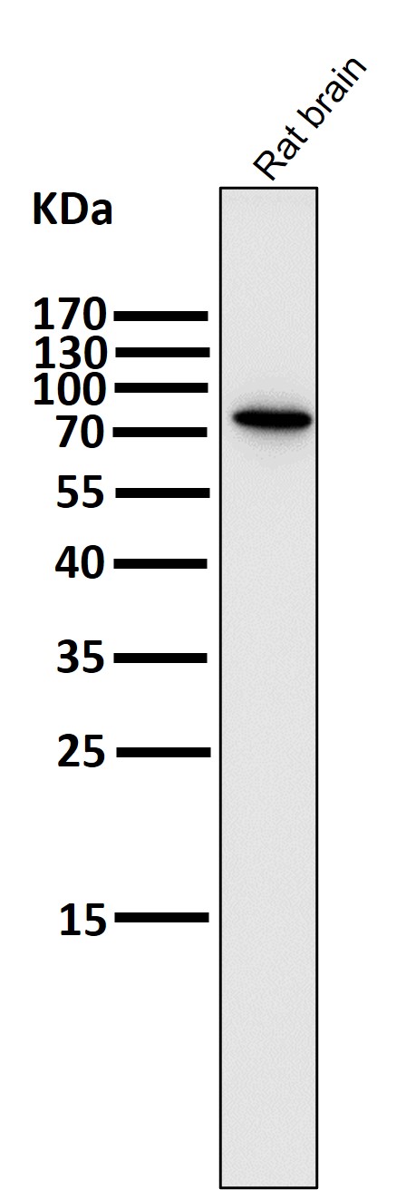 1 - Anti-PI 3 Kinase p85 beta PIK3R2 Rabbit Monoclonal Antibody ABO14272