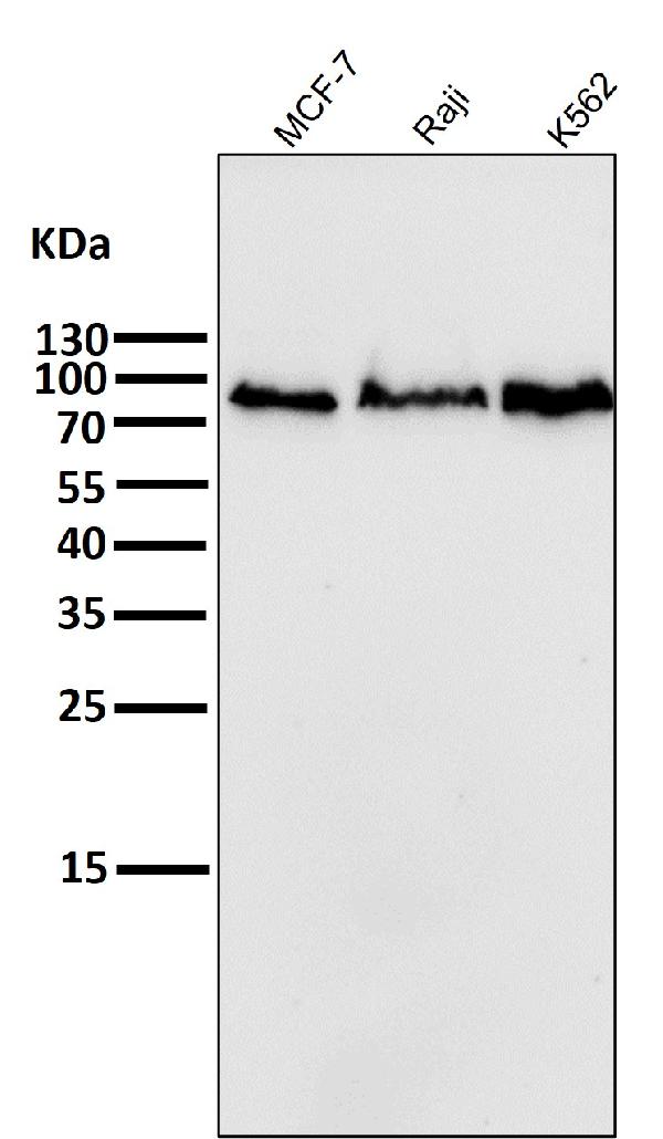 1 - Anti-PI 3 Kinase p85 beta PIK3R2 Rabbit Monoclonal Antibody ABO14272