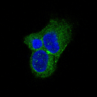 3 - Anti-Tyrosine Hydroxylase TH Rabbit Monoclonal Antibody ABO14273