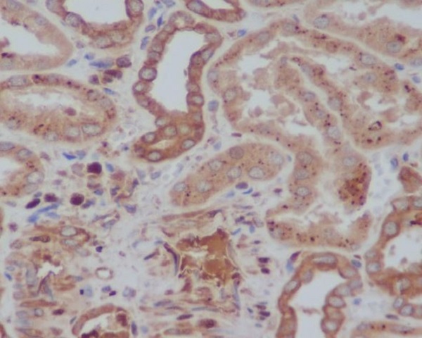 2 - Anti-Tyrosine Hydroxylase TH Rabbit Monoclonal Antibody ABO14273