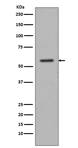 1 - Anti-Tyrosine Hydroxylase TH Rabbit Monoclonal Antibody ABO14273