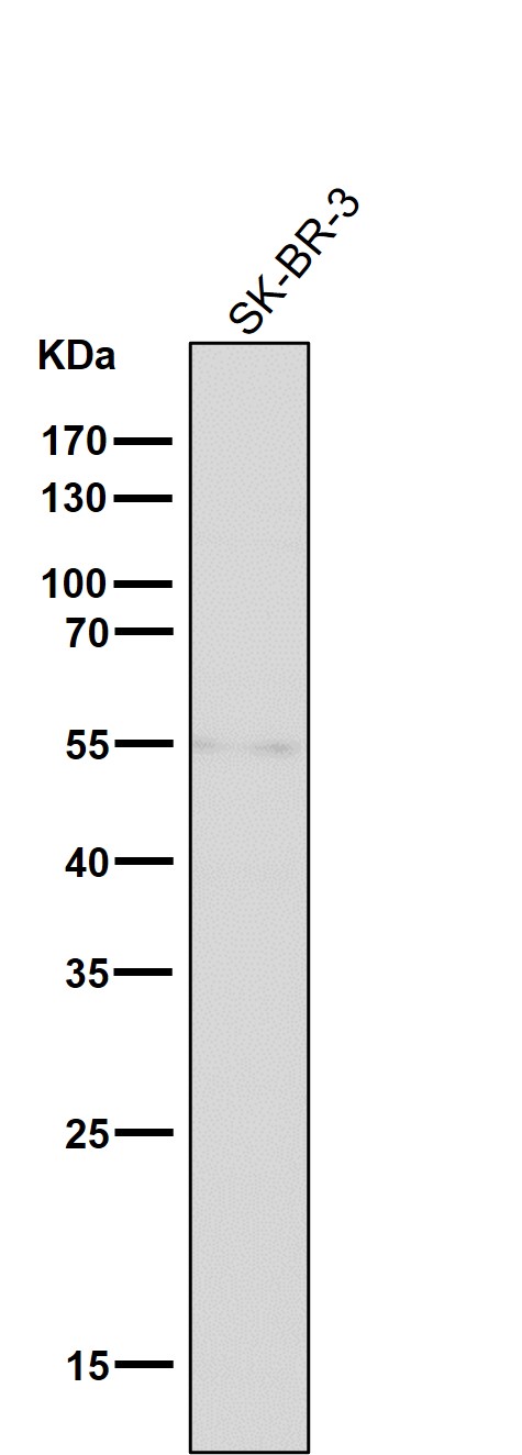1 - Anti-Tyrosine Hydroxylase TH Rabbit Monoclonal Antibody ABO14273