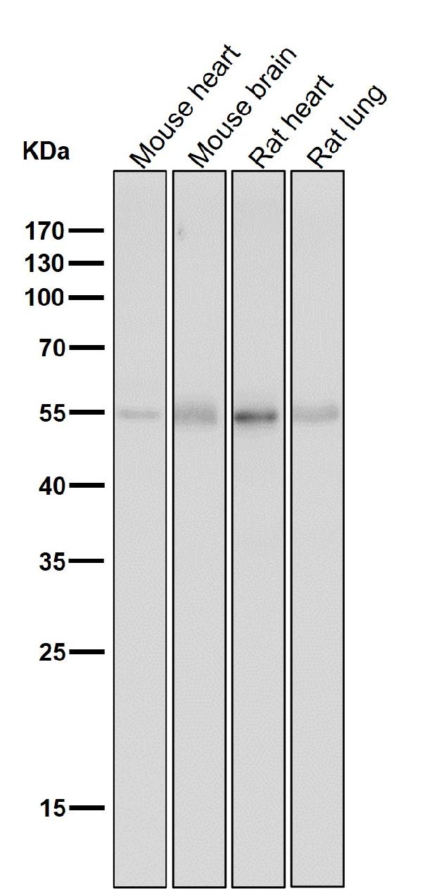 1 - Anti-Tyrosine Hydroxylase TH Rabbit Monoclonal Antibody ABO14273