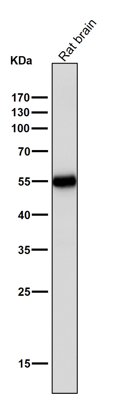 1 - Anti-Tyrosine Hydroxylase TH Rabbit Monoclonal Antibody ABO14273