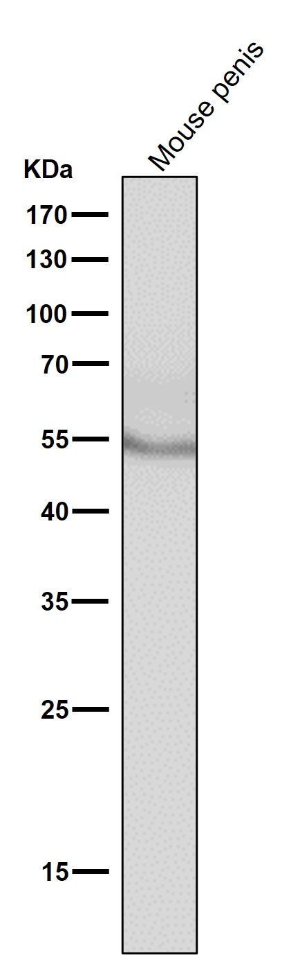 1 - Anti-Tyrosine Hydroxylase TH Rabbit Monoclonal Antibody ABO14273