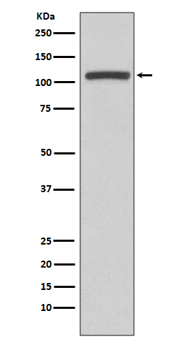 1 - Anti-PI3 Kinase p110 beta PIK3CB Rabbit Monoclonal Antibody ABO14274