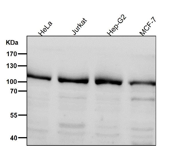 1 - Anti-PI3 Kinase p110 beta PIK3CB Rabbit Monoclonal Antibody ABO14274
