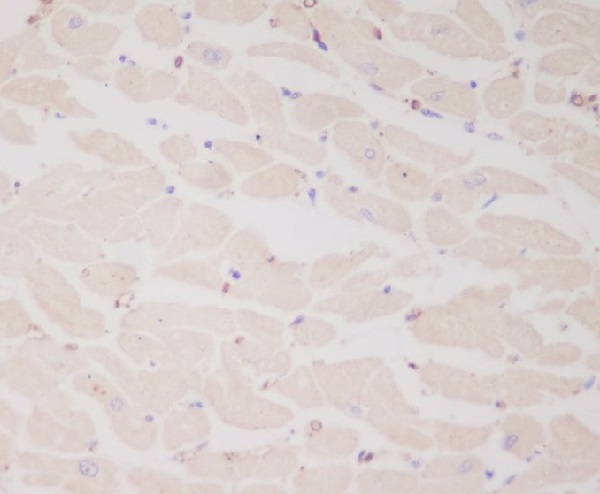 2 - Anti-Myosin Light Chain 2 Rabbit Monoclonal Antibody ABO14275