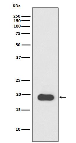 1 - Anti-Myosin Light Chain 2 Rabbit Monoclonal Antibody ABO14275