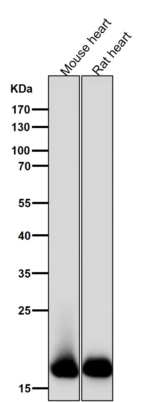 1 - Anti-Myosin Light Chain 2 Rabbit Monoclonal Antibody ABO14275