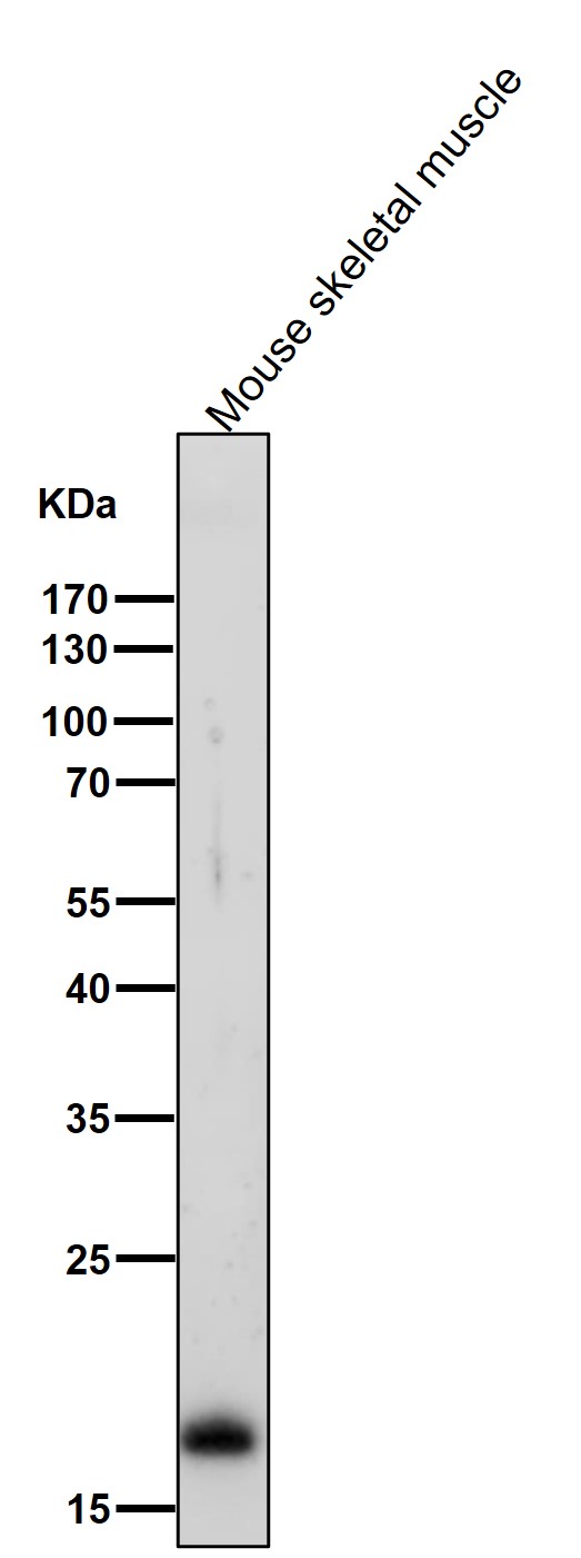 1 - Anti-Myosin Light Chain 2 Rabbit Monoclonal Antibody ABO14275