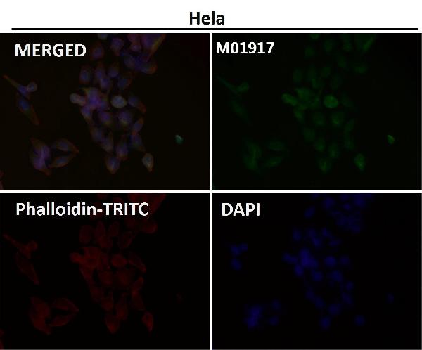 1 - Anti-Tyrosine Hydroxylase TH Rabbit Monoclonal Antibody ABO14276