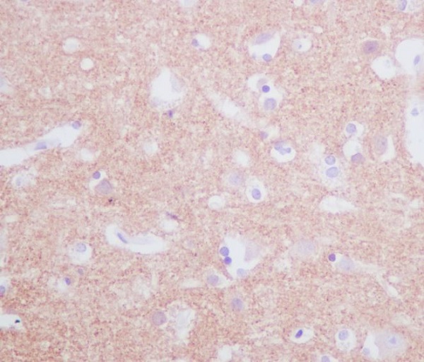 2 - Anti-Tyrosine Hydroxylase TH Rabbit Monoclonal Antibody ABO14276